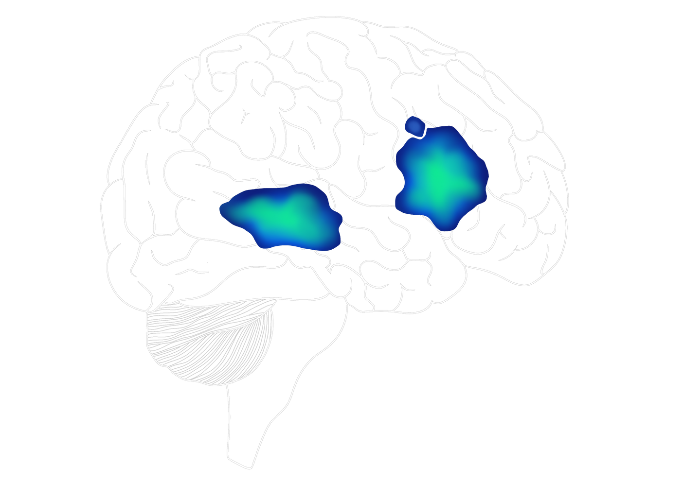 En esta imagen del cerebro se marcan las áreas de Broca y Wernicke imitando a una resonancia magnética funcional. El cerebro esta invertido, mostrando el otro hemisferio.